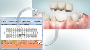 Digitale Patientenaufklärung mit VISIdent und infoskop - BDV Dental GmbH & Co. KG
